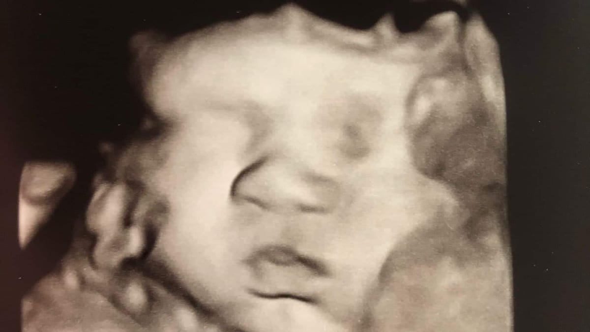 You're never ready for kids