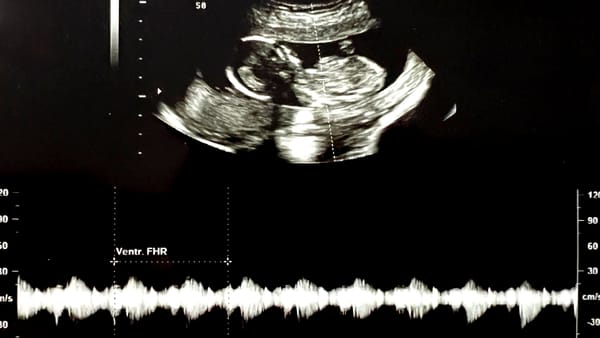 Five years of being a parent